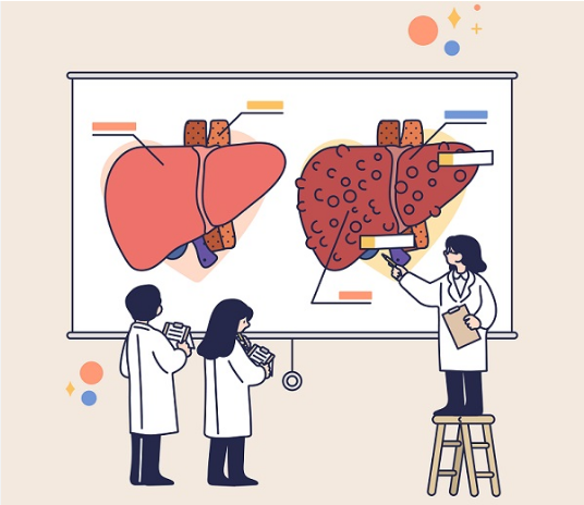 간경변증 조기 발견 체크리스트 – 원인, 증상, 예방법